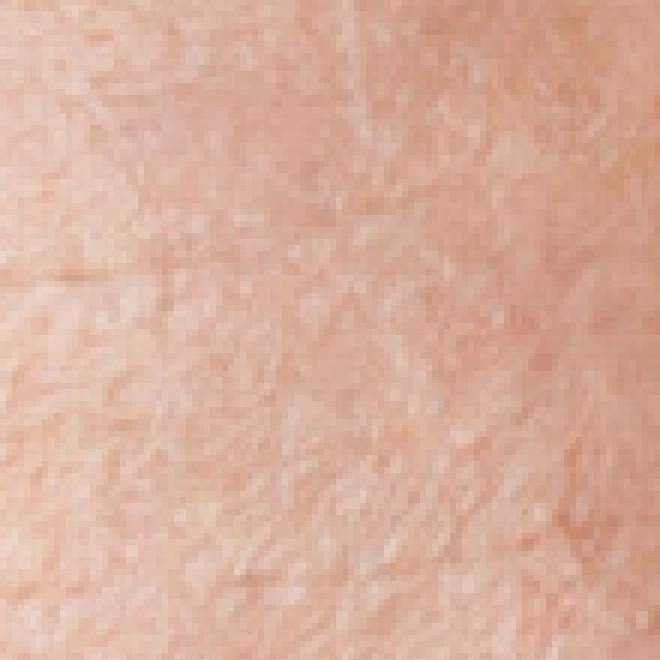 La parte sinistra della fronte dopo la correzione dei segni in rilievo, con la texture della pelle visibile